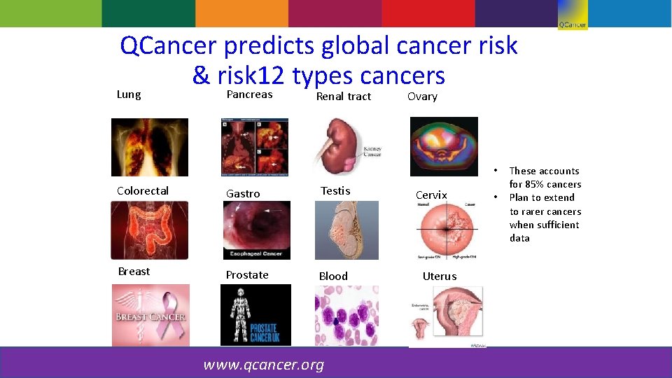 QCancer predicts global cancer risk & risk 12 types cancers Lung Pancreas Renal tract