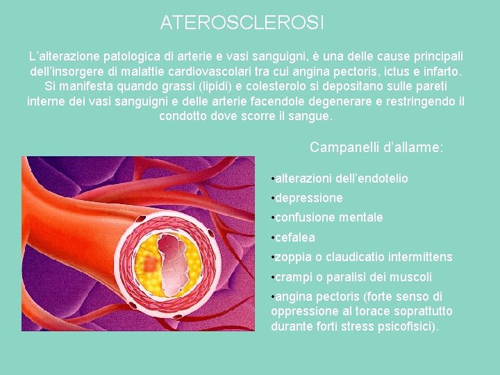 ATEROSCLEROSI L’alterazione patologica di arterie e vasi sanguigni, è una delle cause principali dell’insorgere