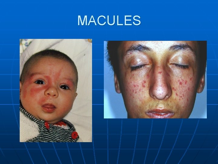 MACULES MACULES