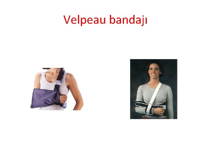 Velpeau bandajı 