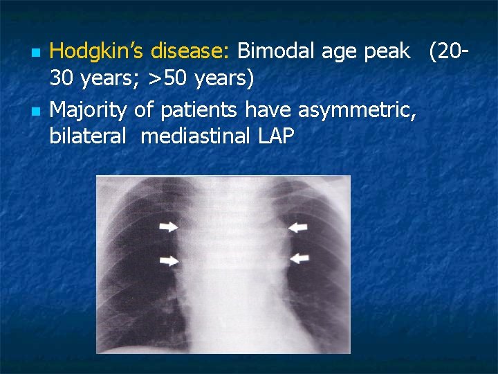 n n Hodgkin’s disease: Bimodal age peak (2030 years; >50 years) Majority of patients