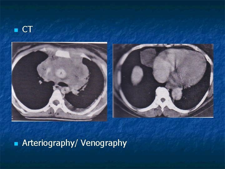 n CT n Arteriography/ Venography 