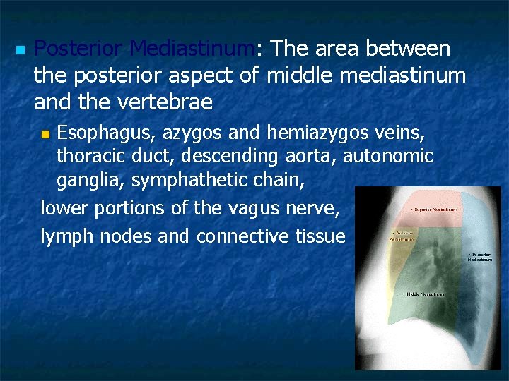 n Posterior Mediastinum: The area between the posterior aspect of middle mediastinum and the