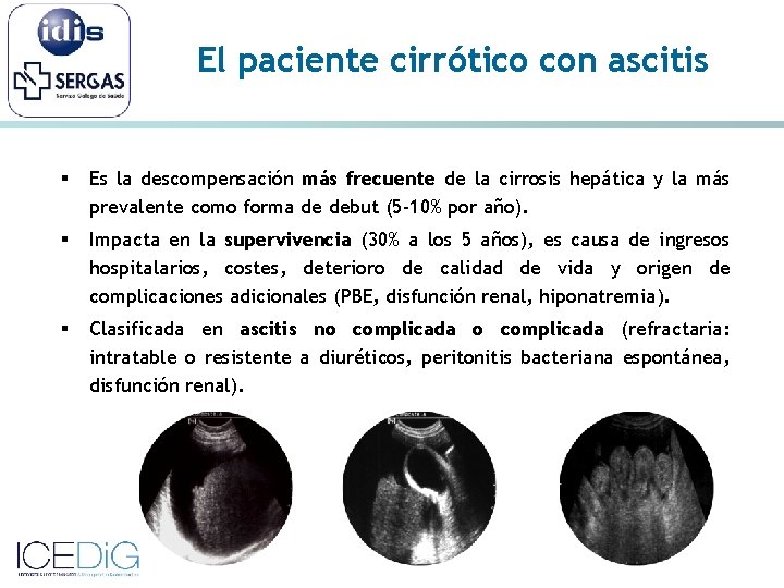 El paciente cirrótico con ascitis § Es la descompensación más frecuente de la cirrosis