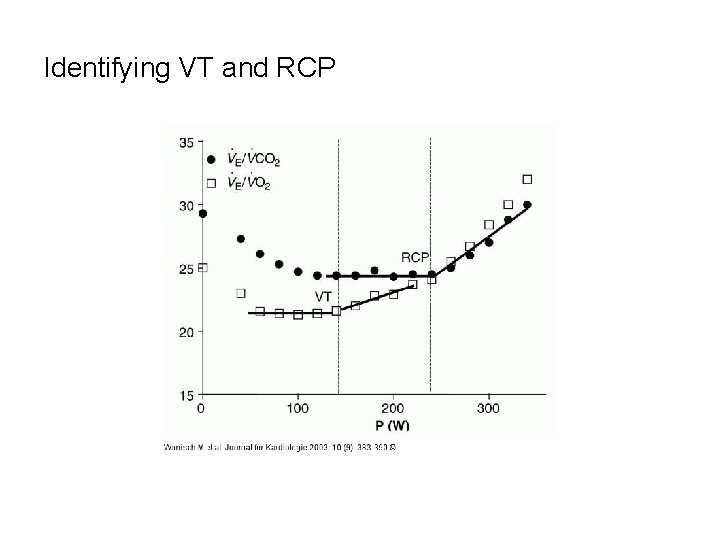 Identifying VT and RCP 