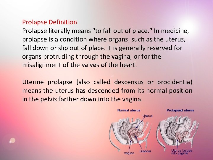 Prolapse Definition Prolapse literally means "to fall out of place. " In medicine, prolapse Prolapse Definition Prolapse literally means "to fall out of place. " In medicine, prolapse