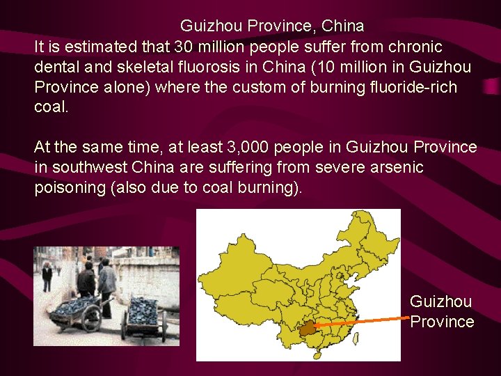 Guizhou Province, China It is estimated that 30 million people suffer from chronic dental