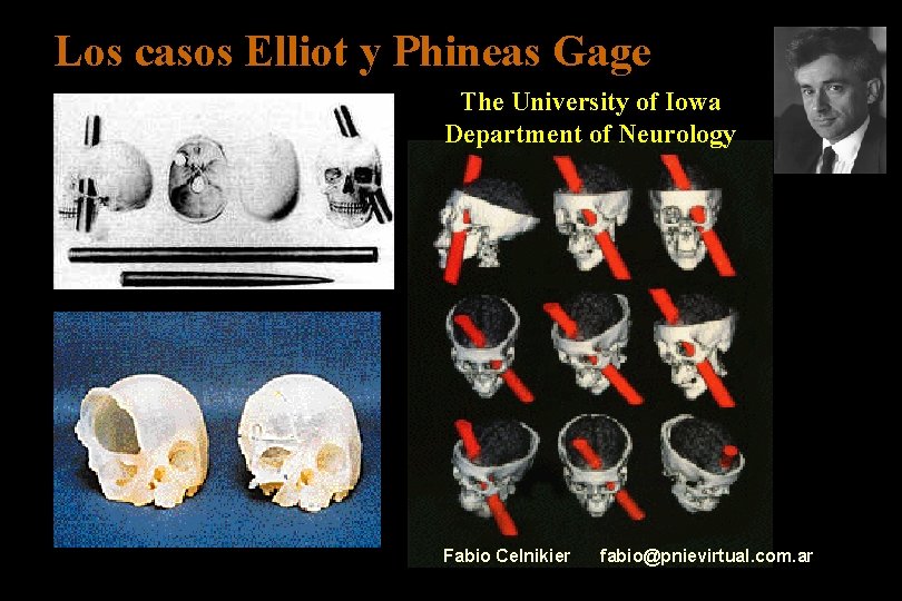 Los casos Elliot y Phineas Gage The University of Iowa Department of Neurology Fabio