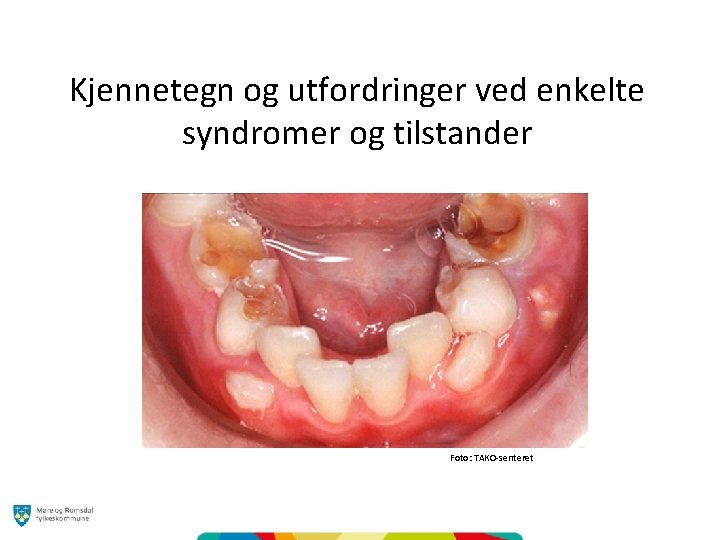 Kjennetegn og utfordringer ved enkelte syndromer og tilstander Foto: TAKO-senteret 