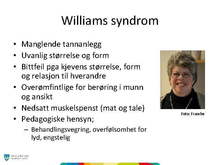 Williams syndrom • Manglende tannanlegg • Uvanlig størrelse og form • Bittfeil pga kjevens