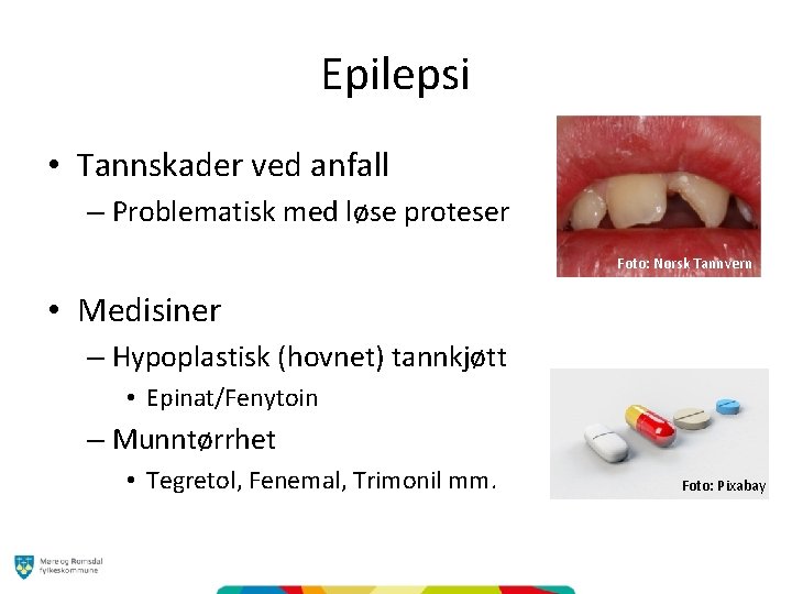 Epilepsi • Tannskader ved anfall – Problematisk med løse proteser Foto: Norsk Tannvern •