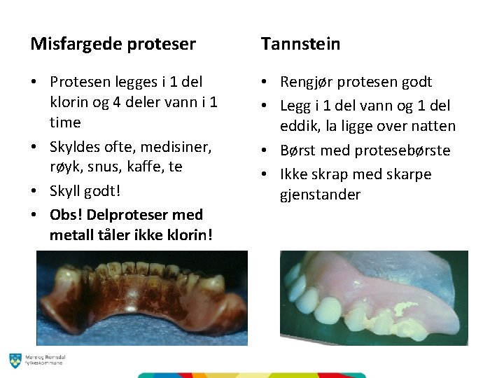 Misfargede proteser Tannstein • Protesen legges i 1 del klorin og 4 deler vann