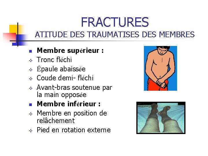 FRACTURES ATITUDE DES TRAUMATISES DES MEMBRES n v v Membre supérieur : Tronc fléchi FRACTURES ATITUDE DES TRAUMATISES DES MEMBRES n v v Membre supérieur : Tronc fléchi