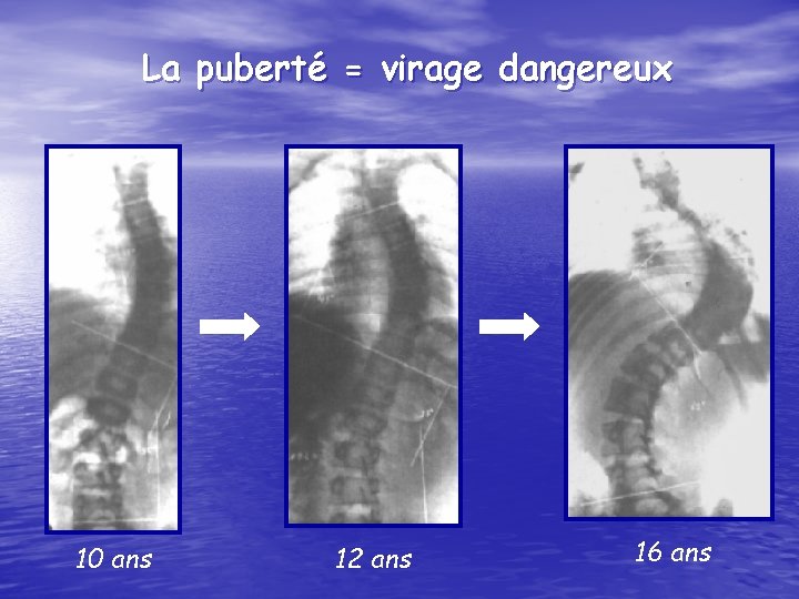 La puberté = virage dangereux 10 ans 12 ans 16 ans 