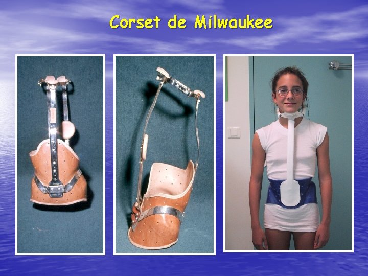 Corset de Milwaukee 