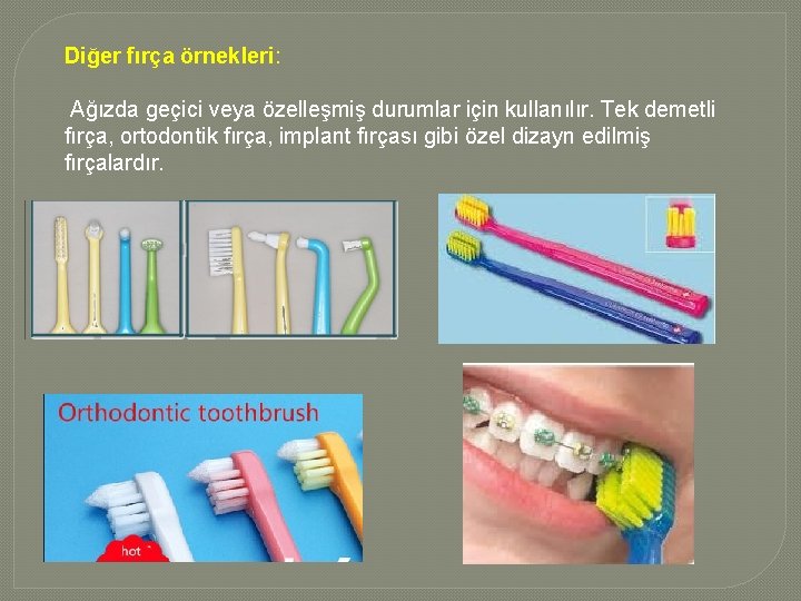 Diğer fırça örnekleri: Ağızda geçici veya özelleşmiş durumlar için kullanılır. Tek demetli fırça, ortodontik