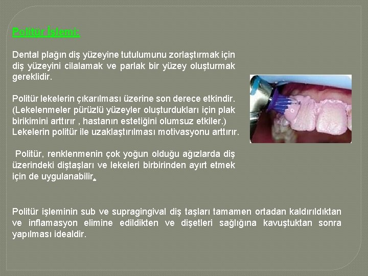 Politür İşlemi: Dental plağın diş yüzeyine tutulumunu zorlaştırmak için diş yüzeyini cilalamak ve parlak