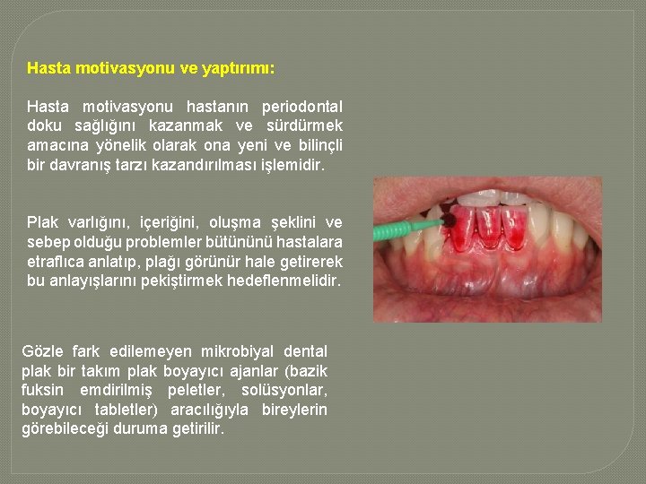 Hasta motivasyonu ve yaptırımı: Hasta motivasyonu hastanın periodontal doku sağlığını kazanmak ve sürdürmek amacına