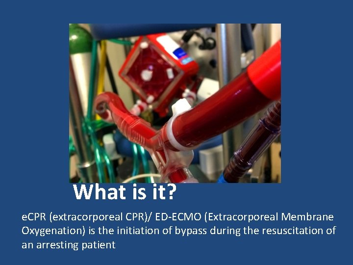 What is it? e. CPR (extracorporeal CPR)/ ED-ECMO (Extracorporeal Membrane Oxygenation) is the initiation