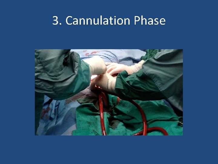 3. Cannulation Phase 