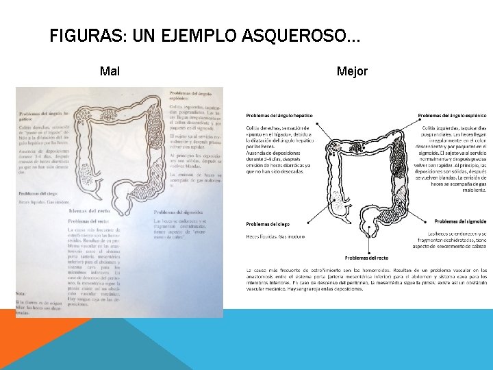 FIGURAS: UN EJEMPLO ASQUEROSO… Mal Mejor FIGURAS: UN EJEMPLO ASQUEROSO… Mal Mejor