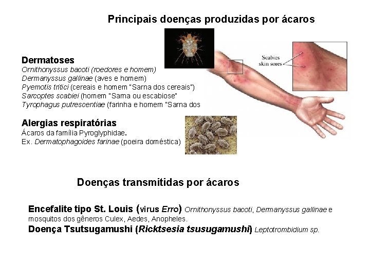 Principais doenças produzidas por ácaros Dermatoses Ornithonyssus bacoti (roedores e homem) Dermanyssus gallinae (aves