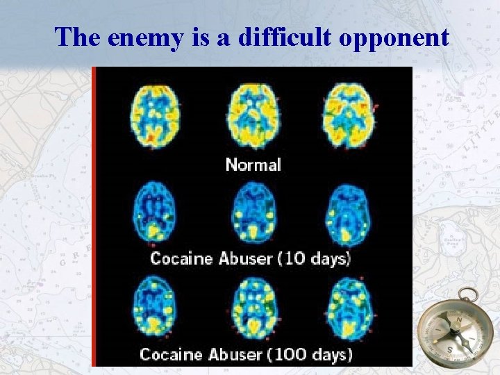 The enemy is a difficult opponent 5 