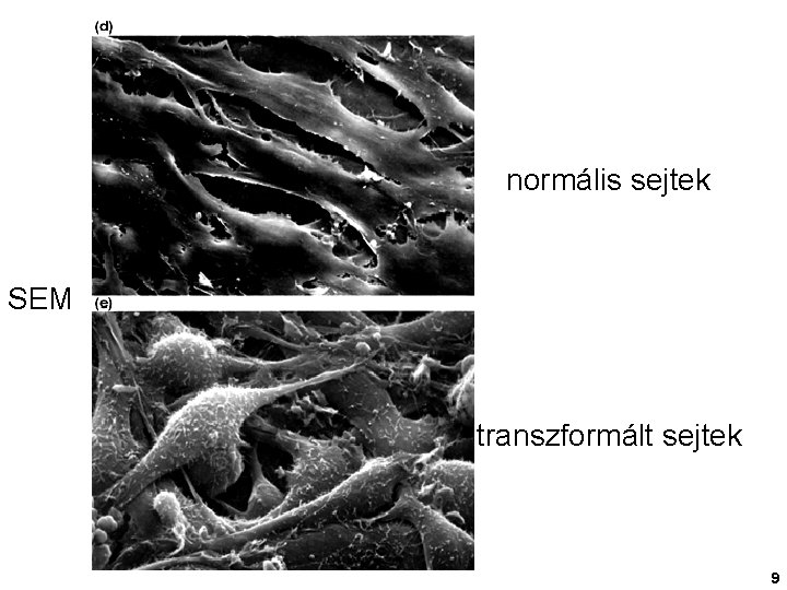 normális sejtek SEM transzformált sejtek 9 