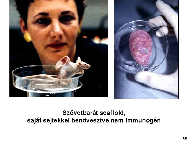 Szövetbarát scaffold, saját sejtekkel benövesztve nem immunogén 68 