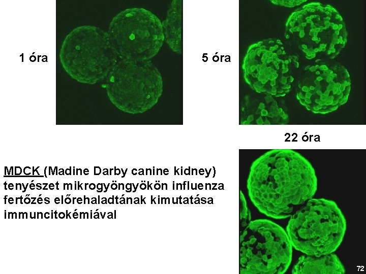 1 óra 5 óra 22 óra MDCK (Madine Darby canine kidney) tenyészet mikrogyöngyökön influenza