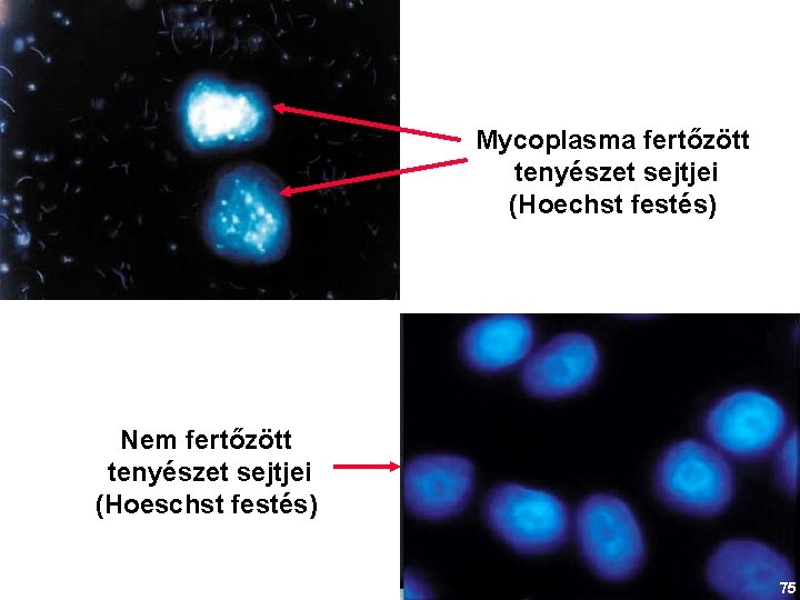 Mycoplasma fertőzött tenyészet sejtjei (Hoechst festés) Nem fertőzött tenyészet sejtjei (Hoeschst festés) 75 
