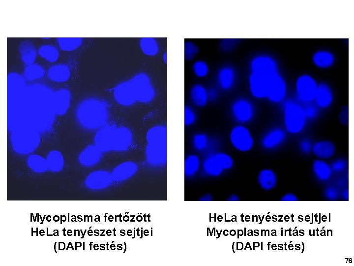 Mycoplasma fertőzött He. La tenyészet sejtjei (DAPI festés) He. La tenyészet sejtjei Mycoplasma irtás