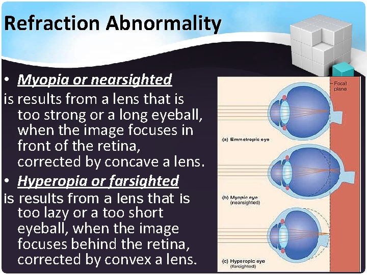 Refraction Abnormality • Myopia or nearsighted is results from a lens that is too