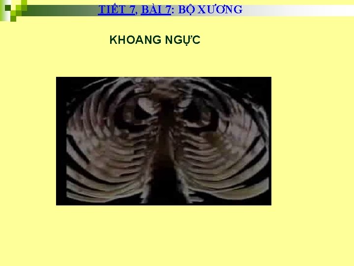 TIẾT 7, BÀI 7: BỘ XƯƠNG KHOANG NGỰC 