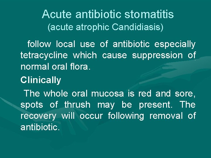 Acute antibiotic stomatitis (acute atrophic Candidiasis) follow local use of antibiotic especially tetracycline which Acute antibiotic stomatitis (acute atrophic Candidiasis) follow local use of antibiotic especially tetracycline which