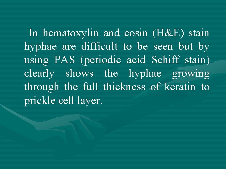 In hematoxylin and eosin (H&E) stain hyphae are difficult to be seen but by