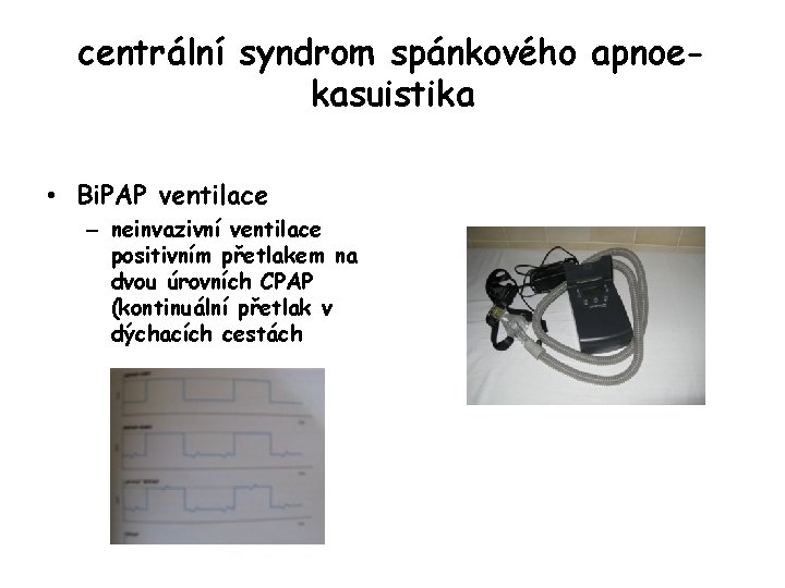 centrální syndrom spánkového apnoekasuistika • Bi. PAP ventilace – neinvazivní ventilace positivním přetlakem na
