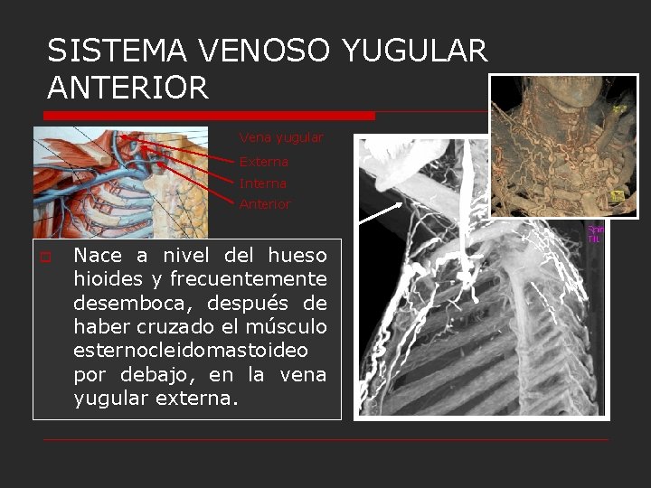 SISTEMA VENOSO YUGULAR ANTERIOR Vena yugular Externa Interna Anterior o Nace a nivel del SISTEMA VENOSO YUGULAR ANTERIOR Vena yugular Externa Interna Anterior o Nace a nivel del
