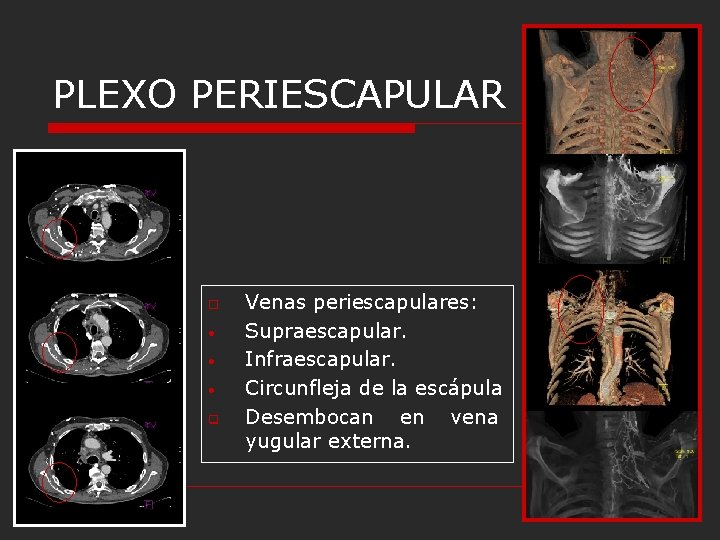 PLEXO PERIESCAPULAR o • • • q Venas periescapulares: Supraescapular. Infraescapular. Circunfleja de la PLEXO PERIESCAPULAR o • • • q Venas periescapulares: Supraescapular. Infraescapular. Circunfleja de la