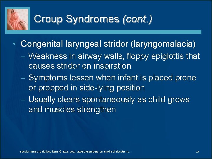 Croup Syndromes (cont. ) • Congenital laryngeal stridor (laryngomalacia) – Weakness in airway walls, Croup Syndromes (cont. ) • Congenital laryngeal stridor (laryngomalacia) – Weakness in airway walls,
