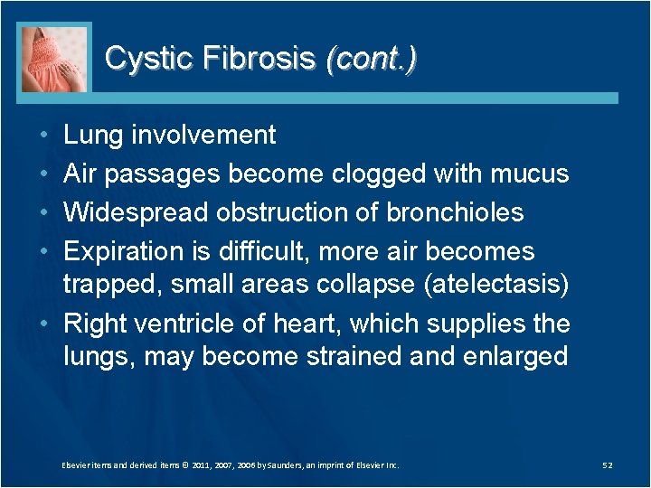Cystic Fibrosis (cont. ) • • Lung involvement Air passages become clogged with mucus Cystic Fibrosis (cont. ) • • Lung involvement Air passages become clogged with mucus