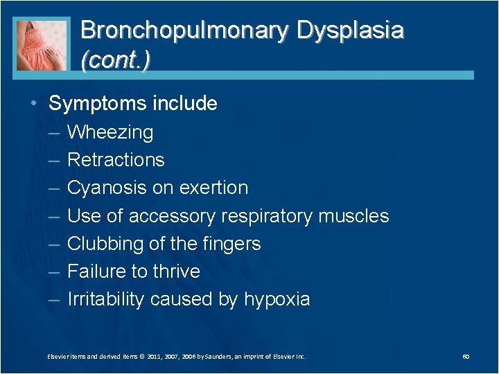 Bronchopulmonary Dysplasia (cont. ) • Symptoms include – – – – Wheezing Retractions Cyanosis Bronchopulmonary Dysplasia (cont. ) • Symptoms include – – – – Wheezing Retractions Cyanosis