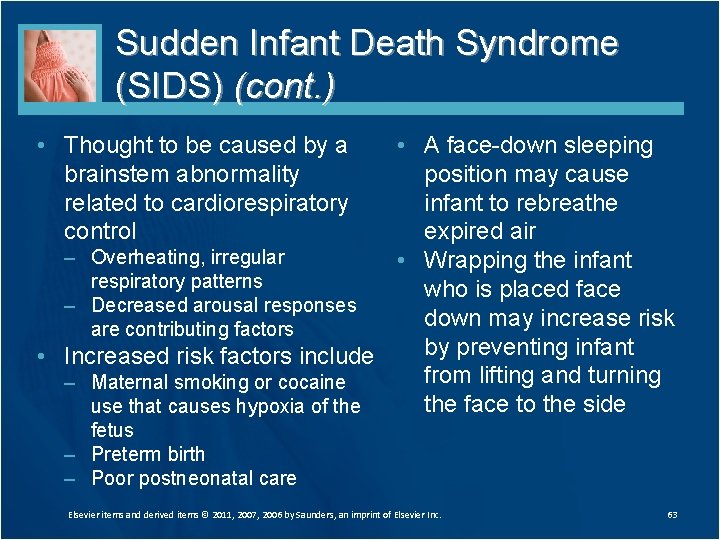 Sudden Infant Death Syndrome (SIDS) (cont. ) • Thought to be caused by a Sudden Infant Death Syndrome (SIDS) (cont. ) • Thought to be caused by a