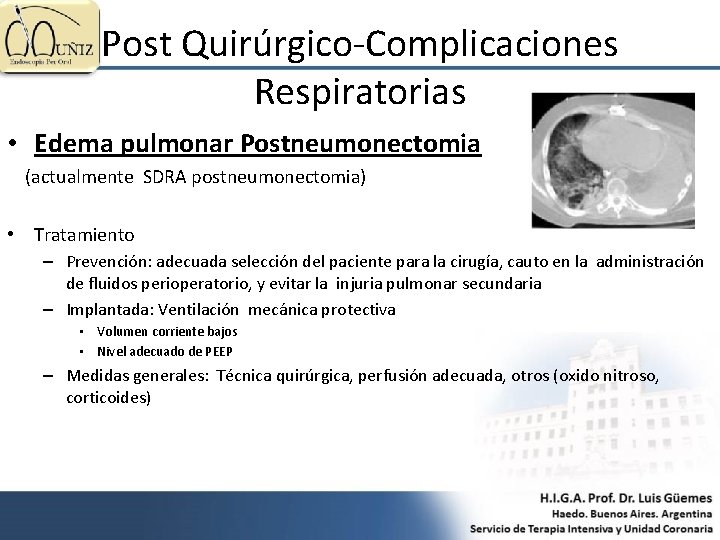 Post Quirúrgico-Complicaciones Respiratorias • Edema pulmonar Postneumonectomia (actualmente SDRA postneumonectomia) • Tratamiento – Prevención: