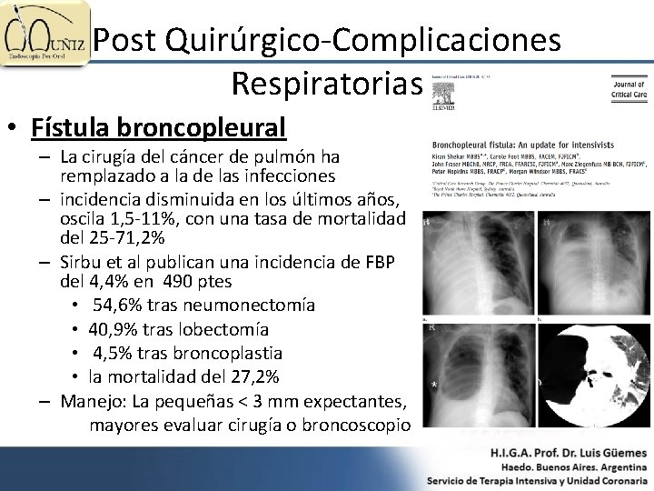 Post Quirúrgico-Complicaciones Respiratorias • Fístula broncopleural – La cirugía del cáncer de pulmón ha