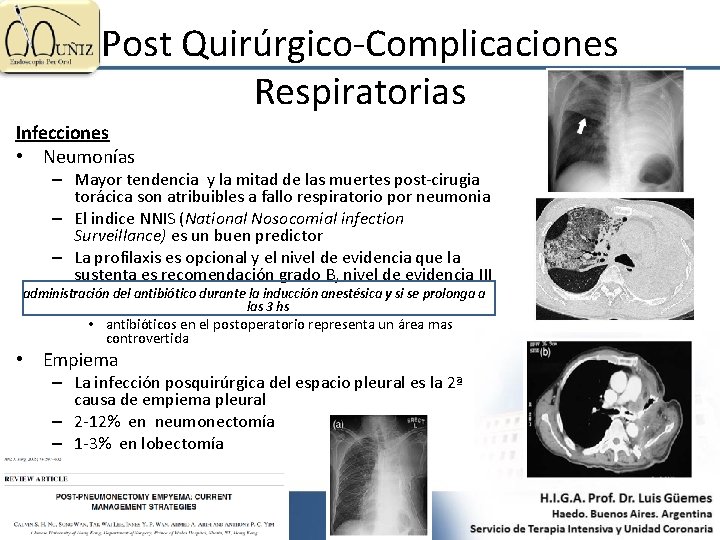 Post Quirúrgico-Complicaciones Respiratorias Infecciones • Neumonías – Mayor tendencia y la mitad de las