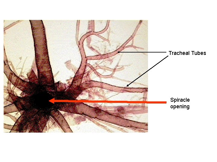 Tracheal Tubes Spiracle opening 