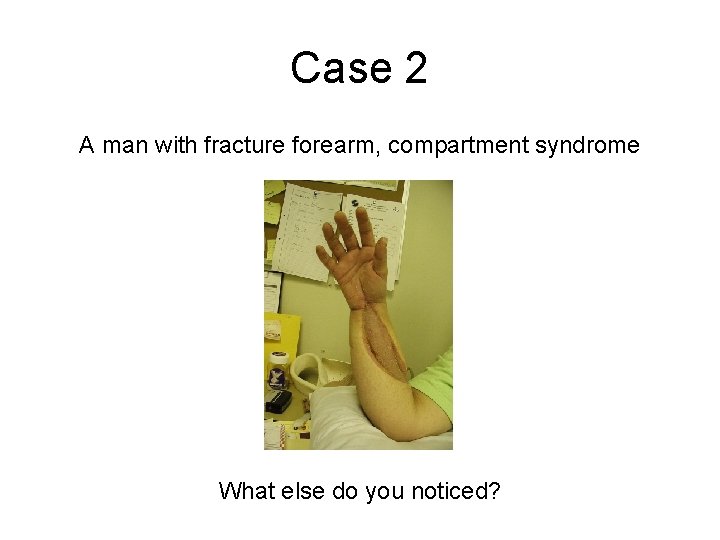 Case 2 A man with fracture forearm, compartment syndrome What else do you noticed? Case 2 A man with fracture forearm, compartment syndrome What else do you noticed?