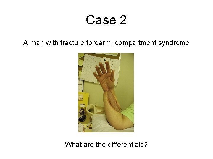 Case 2 A man with fracture forearm, compartment syndrome What are the differentials? Case 2 A man with fracture forearm, compartment syndrome What are the differentials?