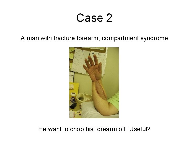 Case 2 A man with fracture forearm, compartment syndrome He want to chop his Case 2 A man with fracture forearm, compartment syndrome He want to chop his